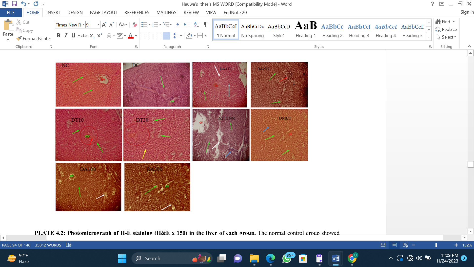 Photomicrograph of H&E-Stained Liver Sections (H&E, x150) from Diabetes-Induced Rats after Treatment with Varying doses of Tofacitinib, Aspirin, and their Combination.