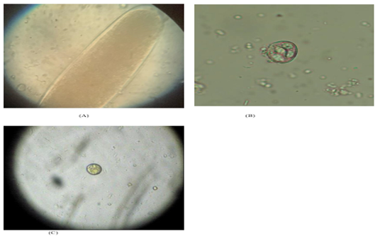 Photomicrographs of Various Parasitic Species. (A) Egg of Strongyle sp.  400x, after Flotation Technique (B) Oocyst of Eimeria sp. 400x, after Flotation Technique and Giemsa's Stain. (C) Ova of Cryptosporidium sp. 400x, after Flotation Technique