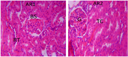 Plate I: Photomicrograph of the kidney from the control group (Ar1r2) showing normal renal architecture, including well-defined glomeruli (G), Bowman’s space (BS), renal tubules (RT), and tubular cells (TC) at ×400 magnification (H&E).
