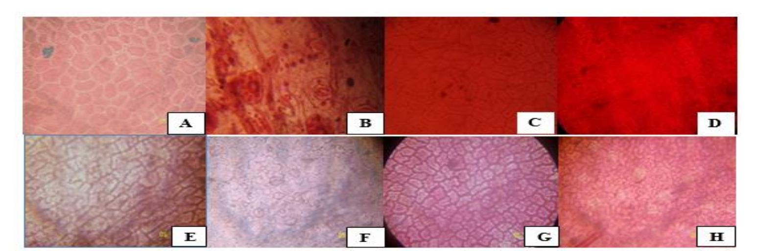 Leaf surfaces in some members of Euphorbiaceae family: Euphorbia heteropyhlla (a and b), a - adaxial surface  showing no stomata, b - abaxial surface showing anisocytic stomata; Euphorbia hirta (c and d), c - adaxial surface no stomata,  d - abaxial surface showing anisocytic stomata; Euphorbia hyssopifolia (e and f), e - adaxial surface showing no stomata, f - abaxial surface showing anomocytic stomata; and Euphorbia prostrate (g and h), g - adaxial surface showing no stomata, h - abaxial surface showing anisocytic stomata