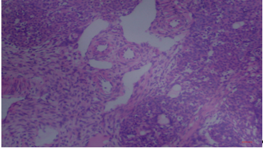 Photomicrograph of Group I showing: well preserved Corpus Luteum (CL), Follicle (F), and Stroma (S) (H&E ×40)